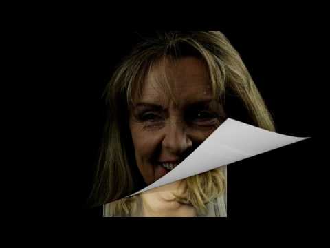 Digital Smile Design Makeover