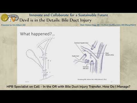 HPB Specialist on Call – In the OR with Bile Duct Injury Transfer, How Do I Manage?