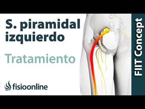 Tratamiento del síndrome piramidal izquierdo