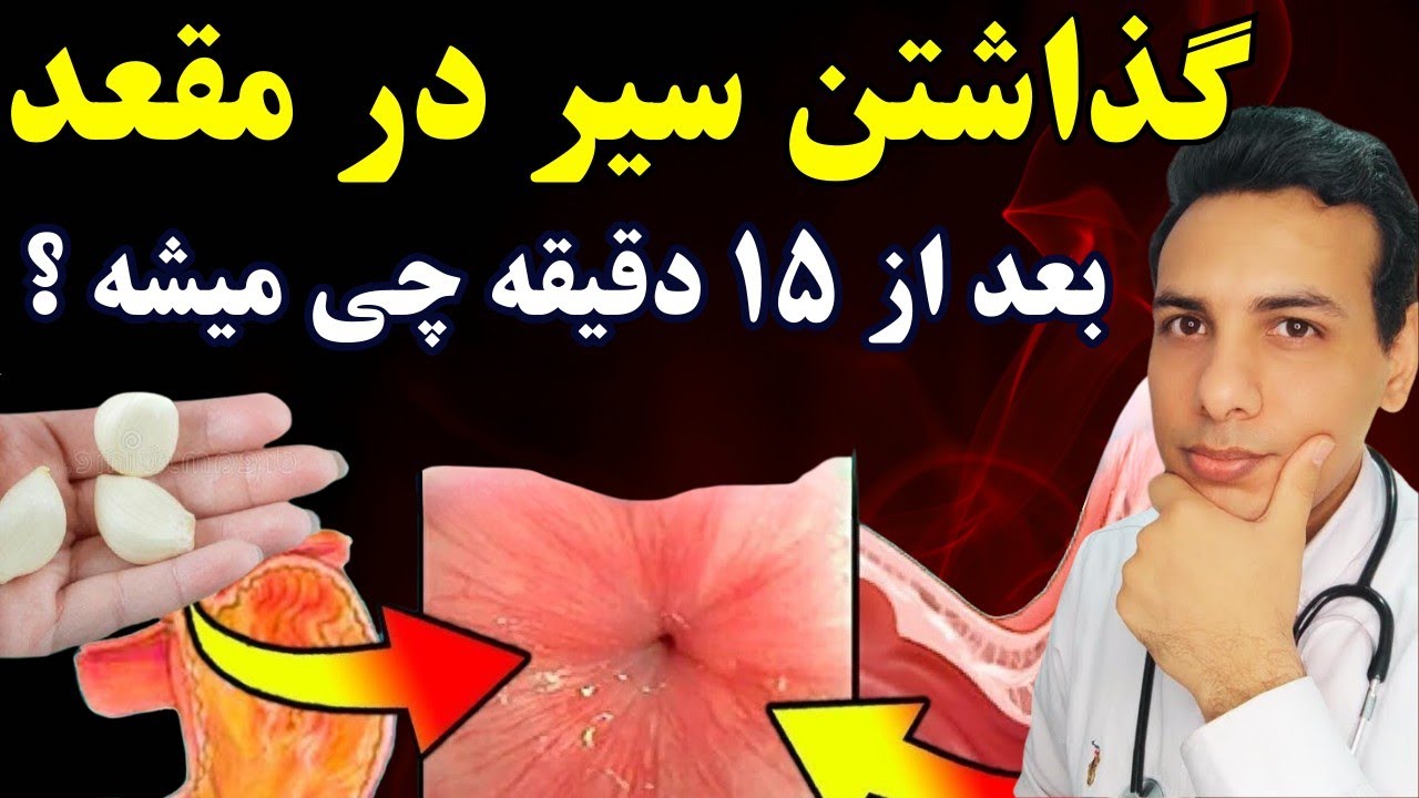 گذاشتن سیر در مقعد برای درمان انگل، پروستات، میکروب معده، بواسیر، زگیل تناسلی و...