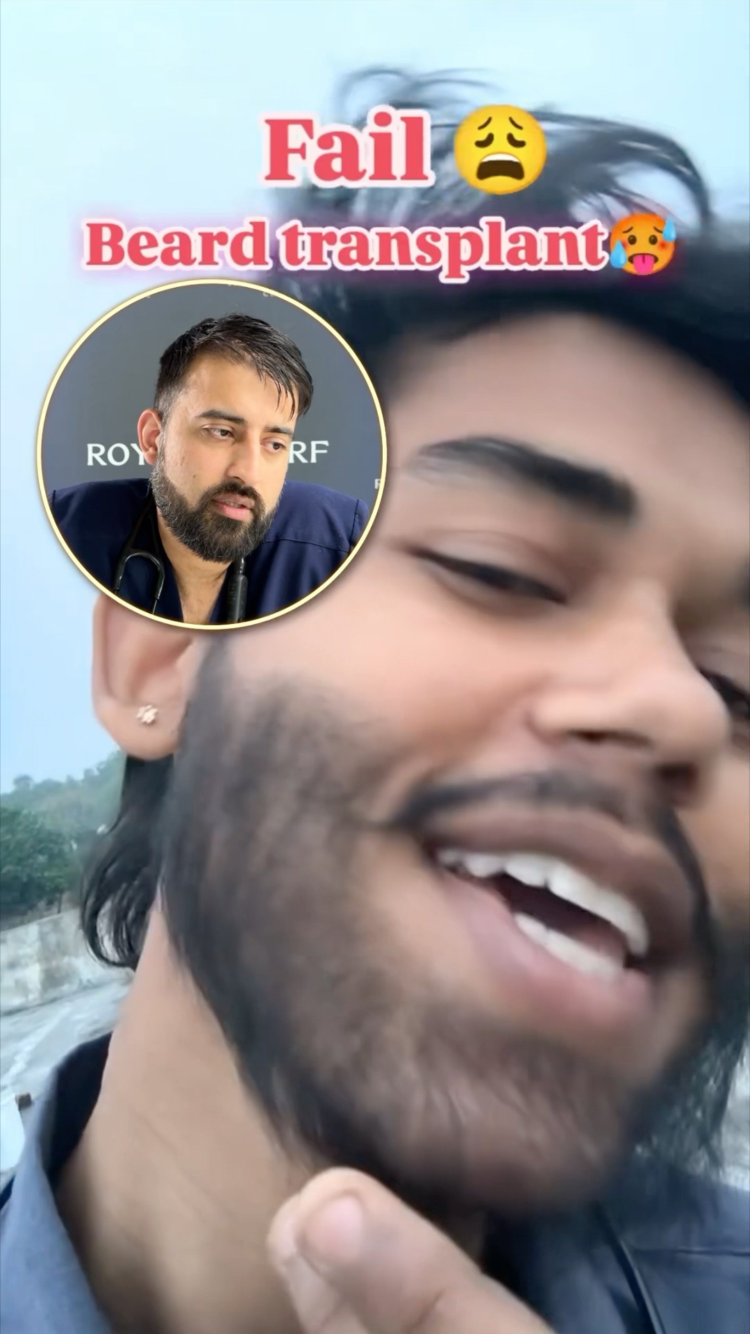 Reacting to the famous Beard Transplant Fail | Ryan Clinics  #fails