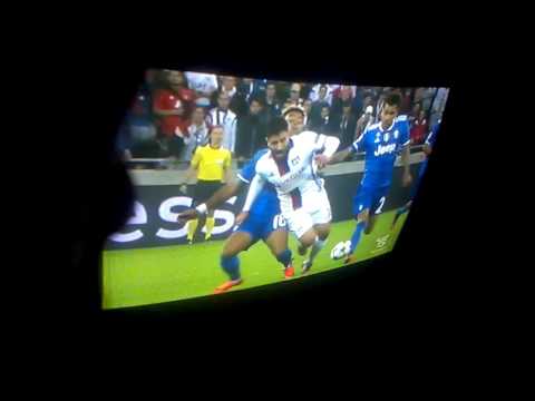 Lione - Juventus 0 - 1 All Goals Highlights UCL 18/10/2016