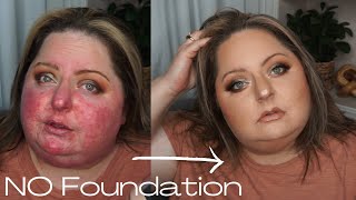 ROSACEA NO FOUNDATION Makeup Routine! How I cover my redness without foundation