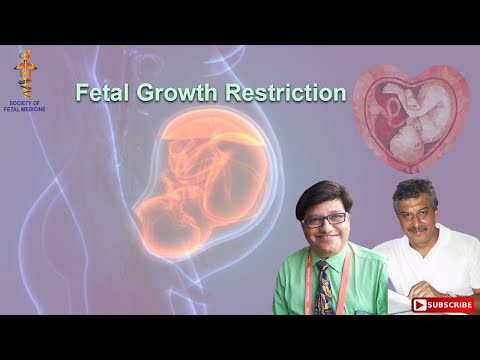 Fetal Growth Restriction