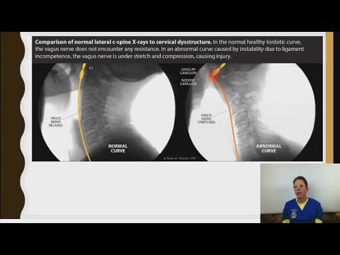 Vagus Nerve Function & Pathology Webinar - Part 1- Ross Hauser, MD