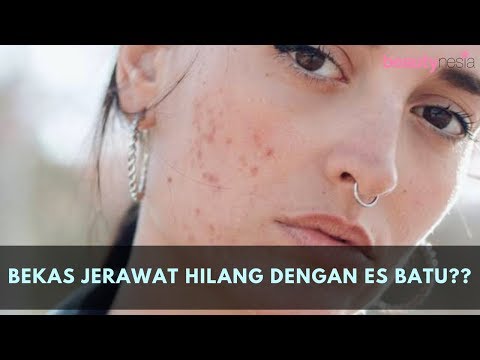 youtube:CnqB55Lxnpc