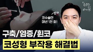 [Dr.유퀴즈온더바이브] 코성형 후 부작용 의심되면 꼭 보세요! 염증, 구축, 휜코 대처방법