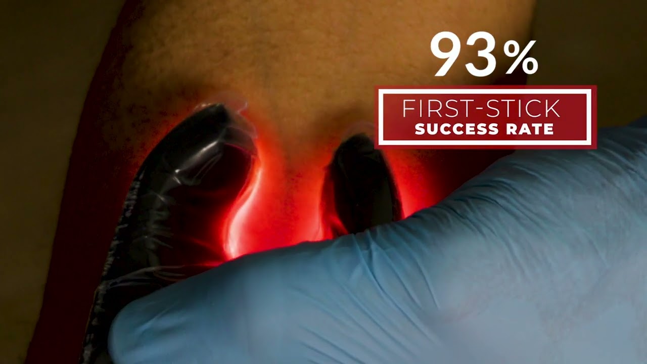 Veinlite EMS PRO – The ONLY tool for fast, easy IV access for emergency medicine