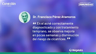 La autoestima del acné | Dr. Francisco Pérez Atamoros | Destacado 1 | Conexión Megalabs