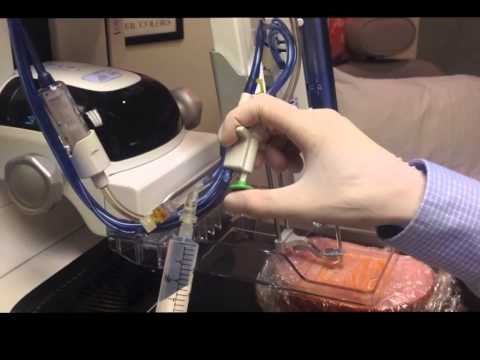 Tomo-guided breast biopsies