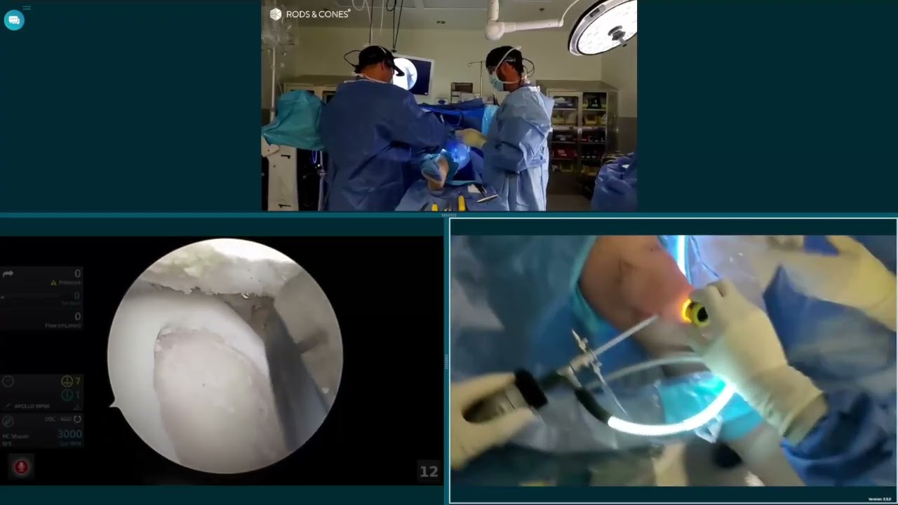 Dr. Garcia demonstrates his updated MACI Arthro Live Surgery