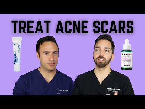 HOW TO TREAT ACNE SCARS | DOCTORLY