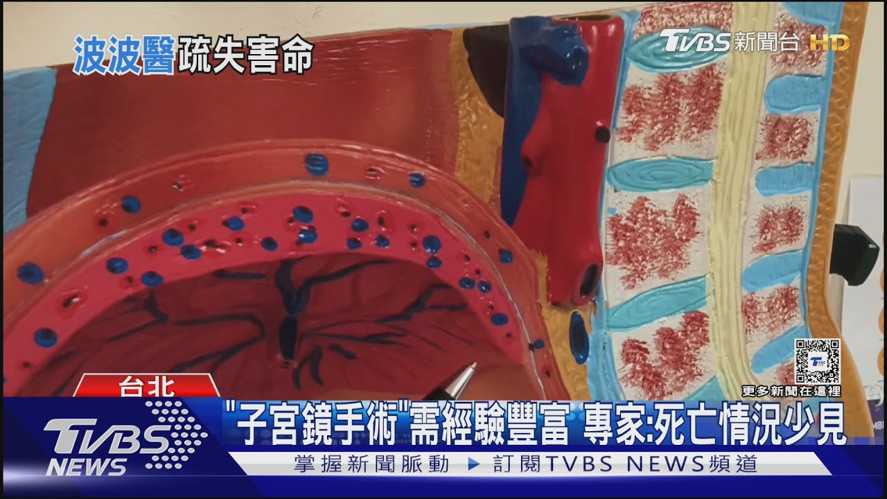 美女醫「刺穿子宮」出人命!遭起底是「波波醫」