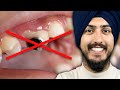 DENTIST Explains His Routine To NEVER Get A Cavity
