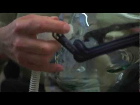 What types of sedations are used during atrial fibrillation catheter ablation?