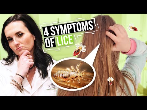 Head Lice Symptoms and Treatment - 4 Signs of Lice to Watch For