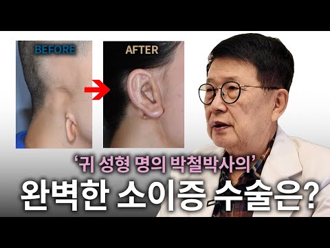 귀성형 전문의 콘텐츠