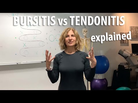 Bursitis vs Tendonitis explained by Irvine Posture Doctor
