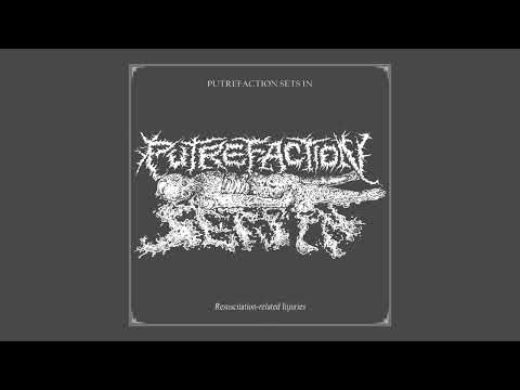 PUTREFACTION SETS IN - Resuscitation-related Injuries - (OFFICIAL SINGLE 2025)