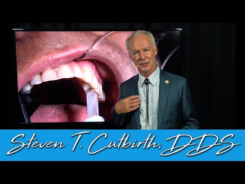 Diagnosing and Treatment of a Cracked Tooth - Dental Minute with Steven T. Cutbirth, DDS