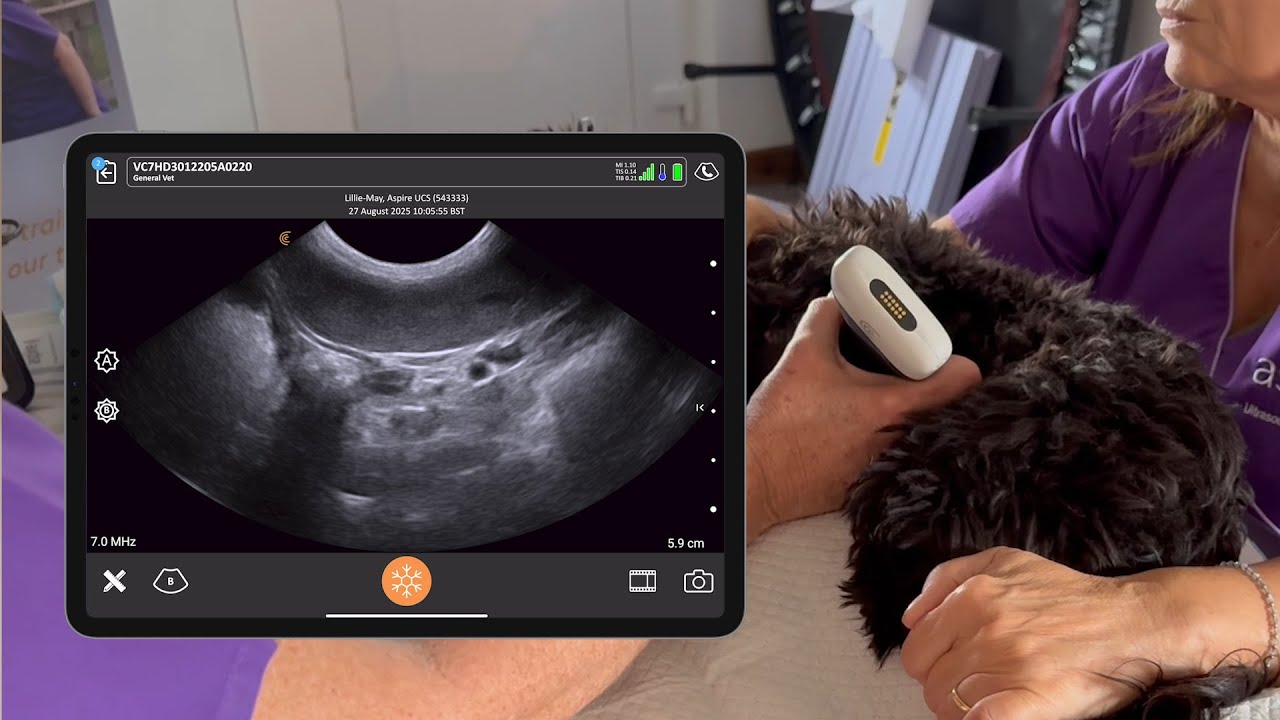 The Aspire UCS 8 Step Abdominal Survey Step 6: Ascending Colon, Coecum, and ICCJ