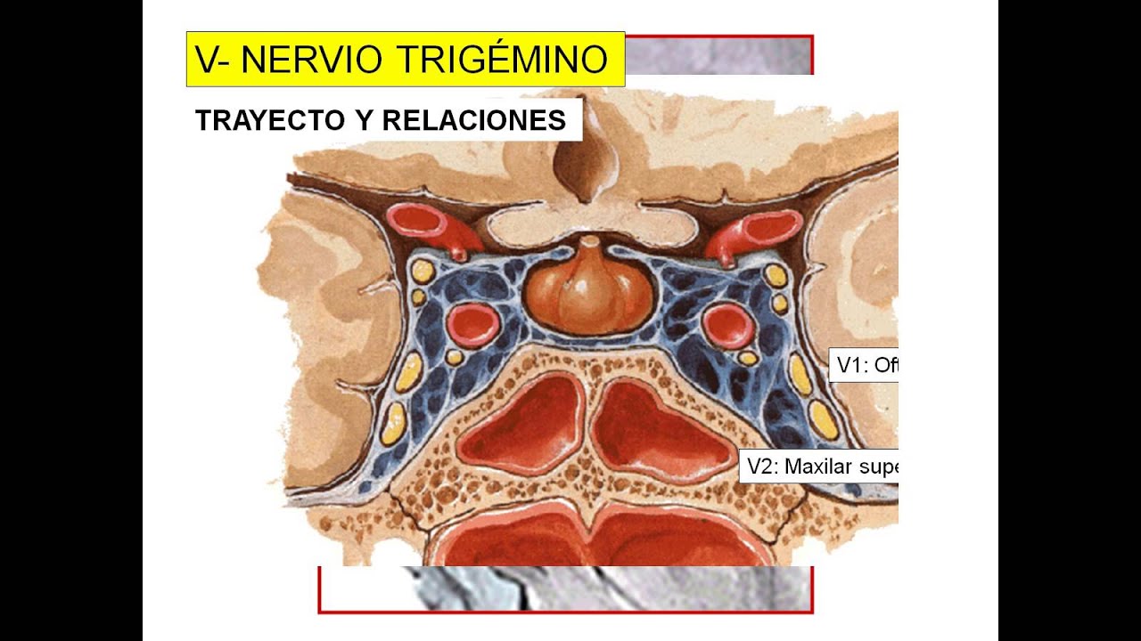 Trigémino pptx