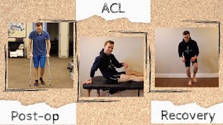 Rehab and Recovery after ACL Reconstruction | What To Expect in the Months Following Surgery