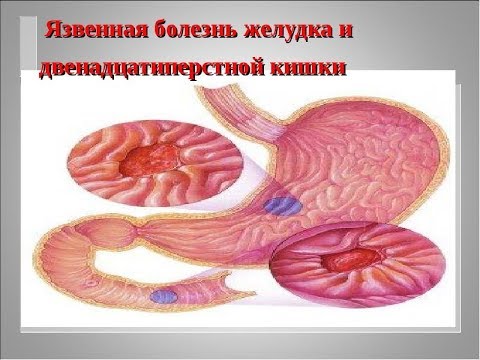 Регенерация двенадцатиперстной кишки и желудка