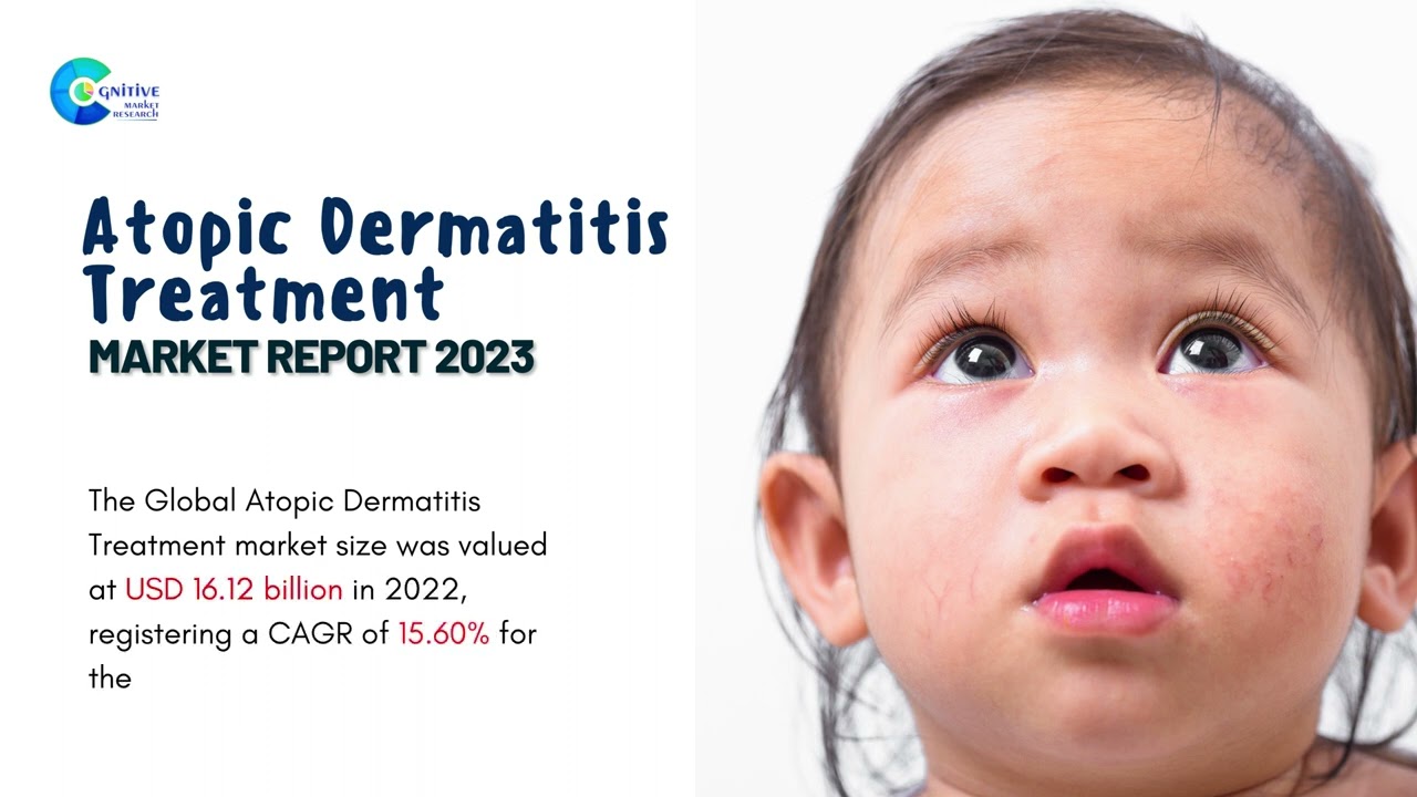 Atopic Dermatitis Treatment  Market Insights