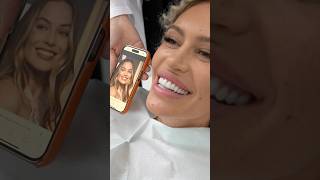 Veneer Transformation, Just like Margot Robbie&#39;s! #hollywoodsmile #veneers #dentalshorts