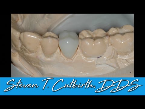 Wie man perfekte Interdentalkontakte herstellt – mit Steven T. Cutbirth, Zahnarzt