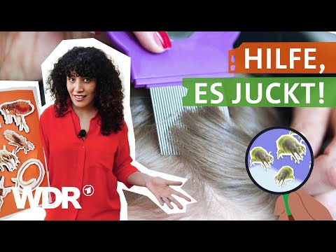 Parasiten: Wenn Läuse, Milben oder Würmer sich beim Menschen einnisten | neuneinhalb | WDR