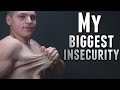 My Biggest Insecurity: Loose Skin 