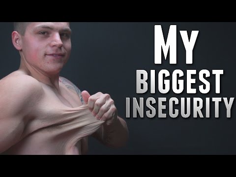 Guy Sheds 160 Pounds, Vlogs About His Loose Skin