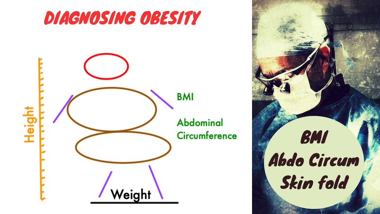 Diagnosing obesity; a quick guide