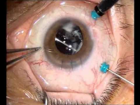 Sagoma di maschera prima di anno nuovo sulla persona Come capire che le borse sotto occhi è lernia