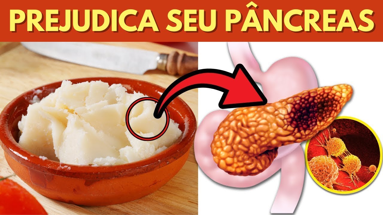 10 alimentos mais perigosos para o pâncreas (risco de câncer de pâncreas)