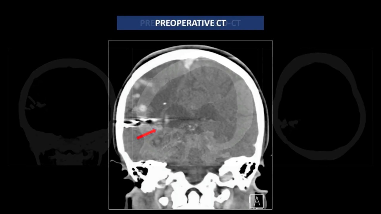 Jean G. De Oliveira-26