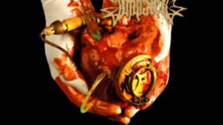 Impaled- Mondo Medicale