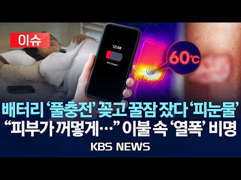 [이슈] 보조배터리 꽂고 꿀잠 잤다 '피눈물'/"피부가 꺼멓게…"이불 속 '열폭' 비명 2026년 9월 27일(일)/KBS