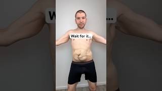 Download lagu Skin Removal Reveal — 10 Million Views 😳 mp3 Download lagu Skin Removal Reveal — 10 Million Views 😳 mp3