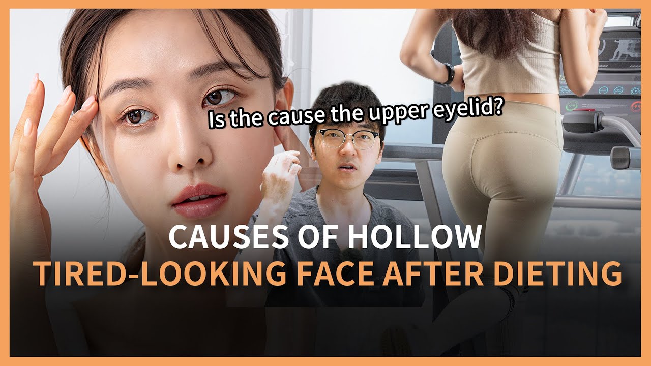 目の下の脂肪再配置