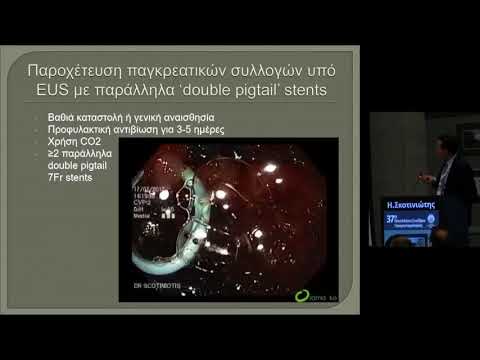 video συνεδρίων on demand