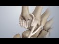 Osteoarthritis of the Thumb: Surgical Treatment (LRTI)