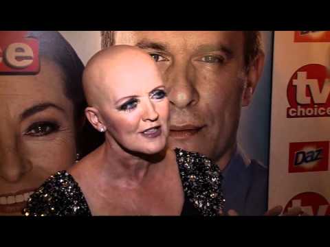 Bernie Nolan debuts bald head as she fights cancer