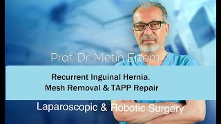 Miniaturka - Recurrent Inguinal hernia Repair. Mesh Removal. Metin Ertem MD.FACS