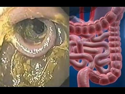 Obat-obatan untuk menurunkan berat badan dari Cina Foto berat badan hamil yang hilang
