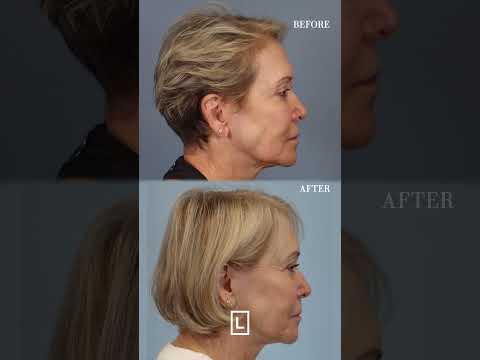 Leong Hair Restoration