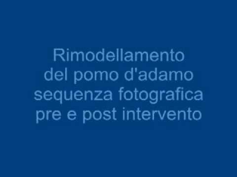 Benda sulla spalla sport congiunte comprare Dolore alle gambe nella parte posteriore nelladdome