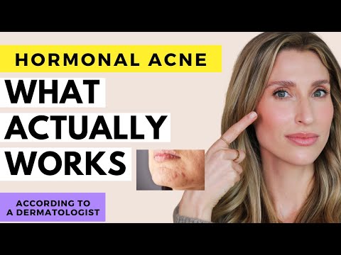 Fix Hormonal Acne For REAL | Dr. Sam Ellis